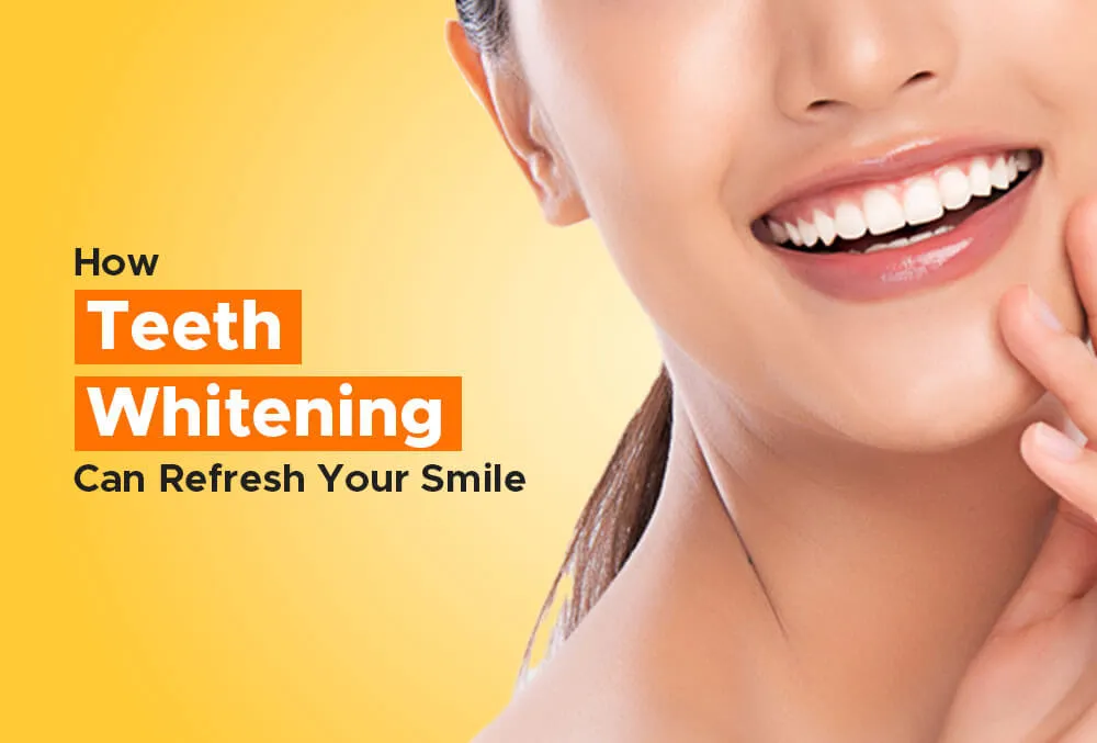 Teeth Whitening