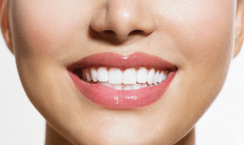 Teeth Whitening