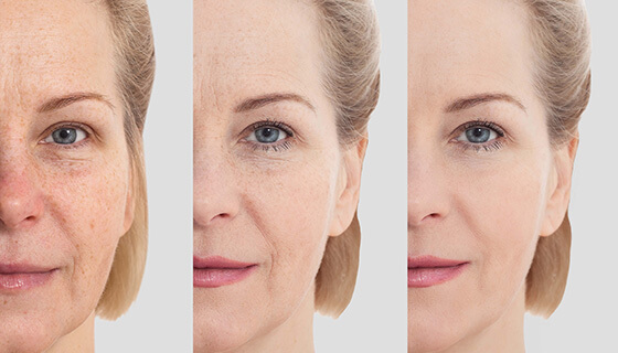 skincare