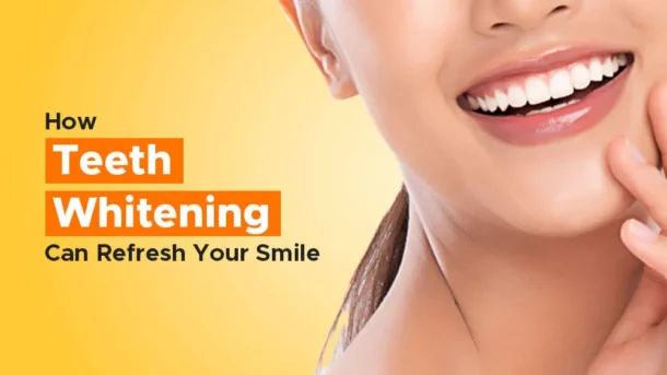 Teeth Whitening
