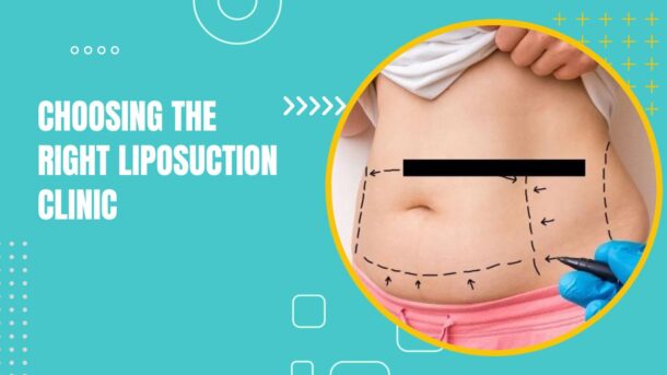 liposuction