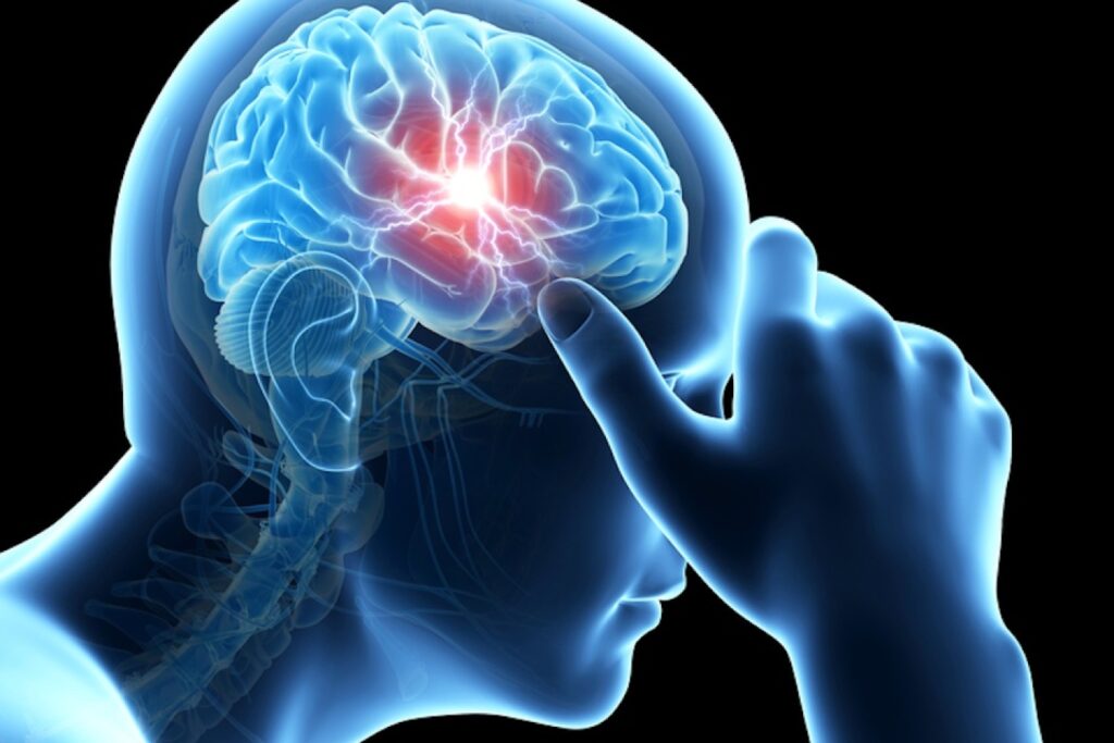 headaches
