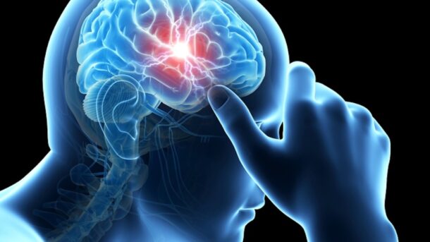 headaches